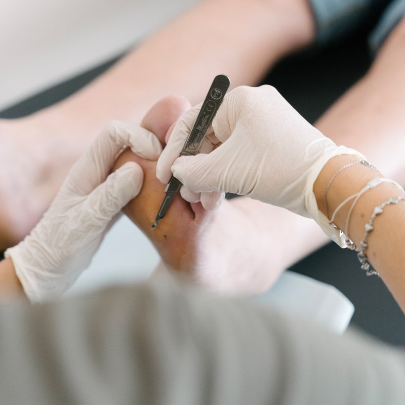 Podologue pour soins des pieds